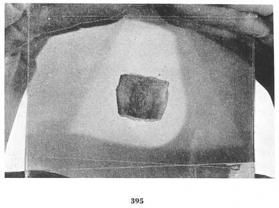 Fig. 395